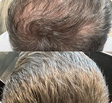 before-after-1 1 (10)