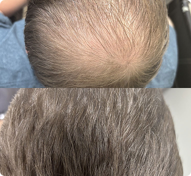 before-after-1 1 (12)