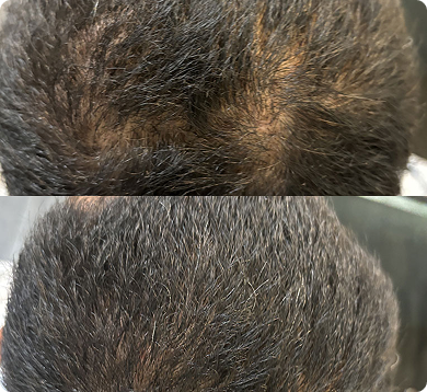 before-after-1 1 (13)