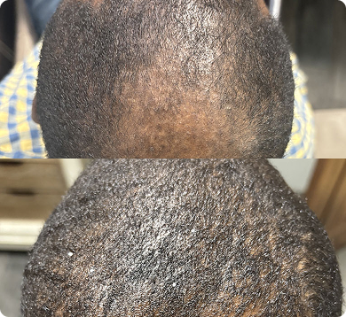 before-after-1 1 (9)